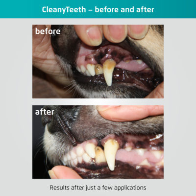 CleanyTeeth before and after pictures